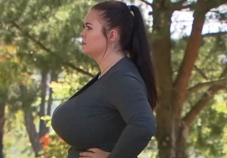 La insólita situación de una mujer, cuyos senos no paran de crecer