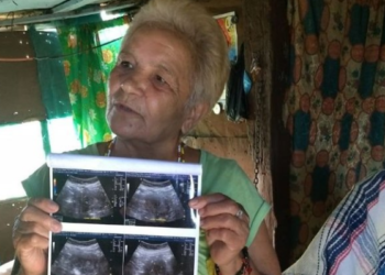 Una mexicana de 70 años podría convertirse en la mujer más longeva en dar a luz