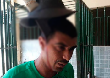 Preso con machete en la cabeza sorprende a Internet por su tranquilidad ante su trágico accidente