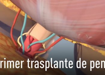 Así fue el primer trasplante de pene y escroto