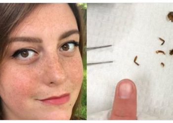 Vivió más de una semana con una cucaracha dentro de su oído