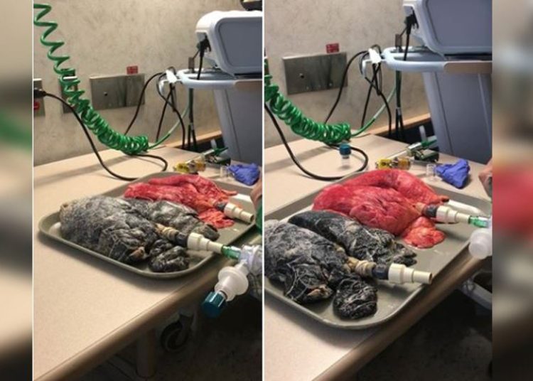 Este es el video que «aterra» a los fumadores