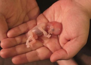 La Cámara de Diputados de Argentina aprueba la ley de aborto legal