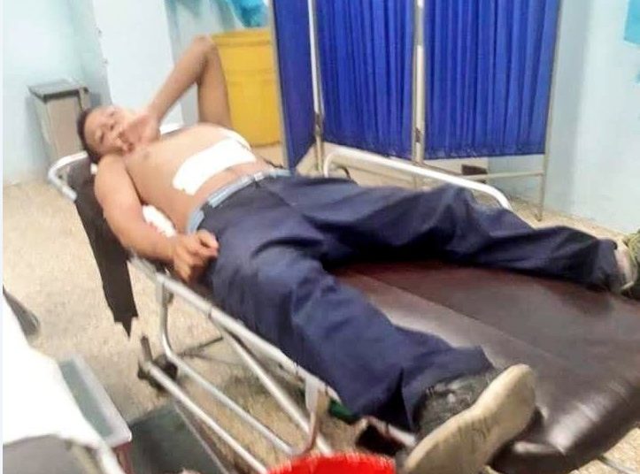 Mujer se defiende de agresiones de su pareja, y de la golpiza lo envía al hospital en Usulután