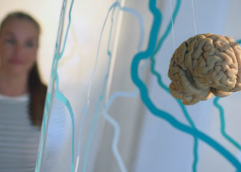 Científicos identifican el momento en que comienza el alzhéimer