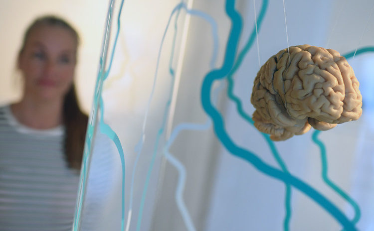 Científicos identifican el momento en que comienza el alzhéimer