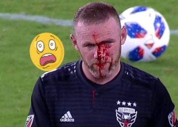 El brutal codazo con el que le fracturaron la nariz a Wayne Rooney en su primer gol en el DC United