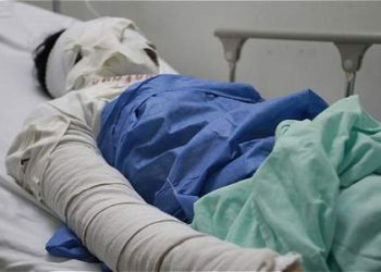 Por este reto viral, un joven terminó quemado y hospitalizado (FOTO)