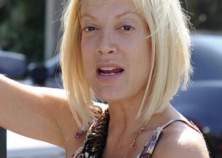 Actriz se deforma la cara por adicción al bótox