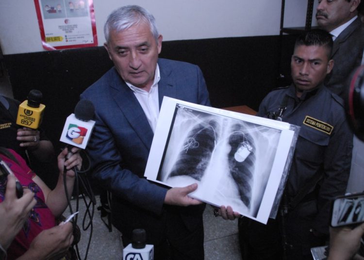 Expresidente guatemalteco, preso por corrupción, está en «alto riesgo» de salud