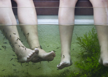 Una mujer pierde los dedos del pie tras una infección ‘comehuesos’ por una pedicura con peces