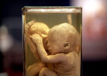 Autoridades hallan 14 fetos en un estanque en India