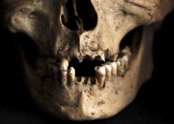 Obreros hallan 1.000 dientes humanos dentro de una pared