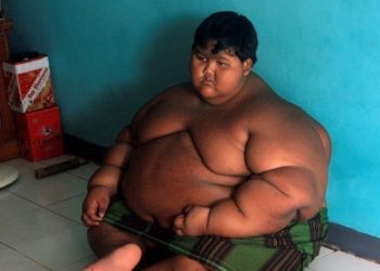 La asombrosa transformación del ‘niño más obeso del mundo’, que ahora quiere ser futbolista