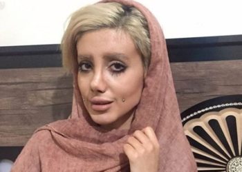 Las espeluznantes fotografías que publicó Sahar Tabar, la «Angelina Jolie» iraní