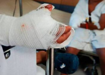 Seis personas quemadas y siete fallecidos en accidentes de tránsito en el primer día del Plan Belén