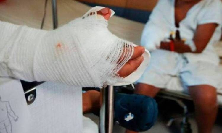 Seis personas quemadas y siete fallecidos en accidentes de tránsito en el primer día del Plan Belén