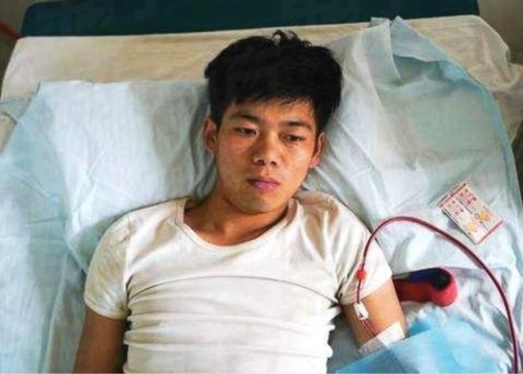 Vendió su riñón para comprar un iPhone y ahora necesita diálisis de por vida