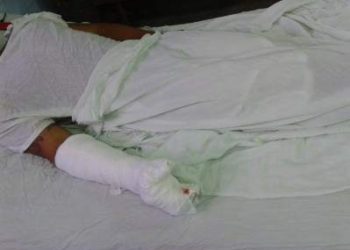 Le amputan la mano a un niño que le explotó un mortero