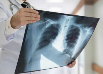 OMS: Cáncer afecta en particular a países de ingresos medios y bajos