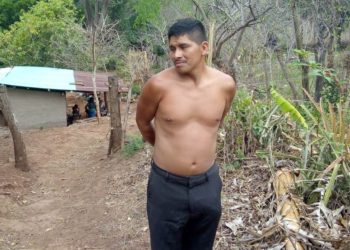 Capturan a hombre que quemó las manos a su hija por presuntamente robar dinero