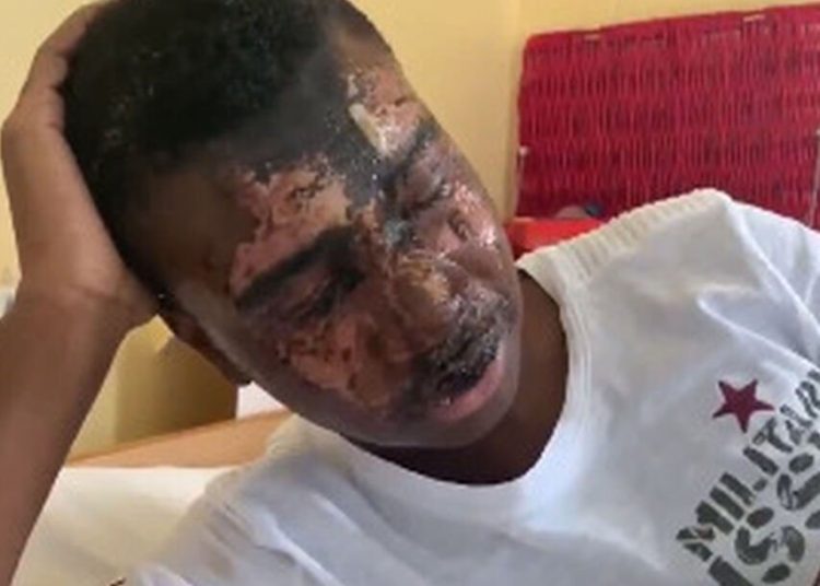 (VIDEO) Tega Agberhiere, futbolista de 16 años, cegado tras haber sido atacacdo con ácido