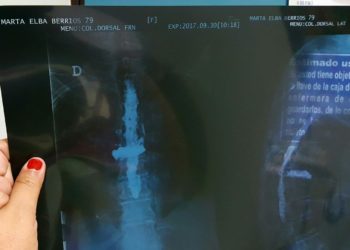 Acusan de homicidio culposo a médico columnólogo que realizó mala praxis en San Miguel