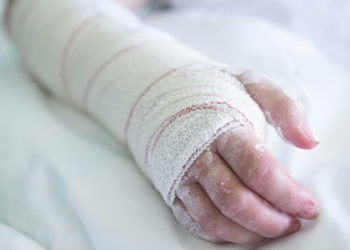 Indigente quema vivo a un niño de 13 años en México