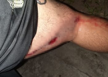 Delincuentes balean a conductor de Uber en Mejicanos