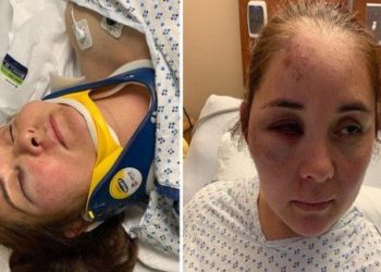 Una madre fue golpeada por un chico 13 años que le hacía «bullying» a su hijo