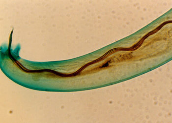 Hawái en alerta por un parásito que invade cerebros humanos