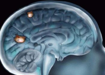 Ameba come cerebros mata a un hombre que nadaba en parque acuático en Estados Unidos