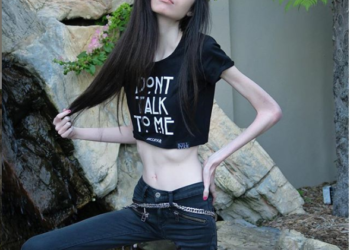 Youtuber extremadamente delgada reaparece con radical cambio