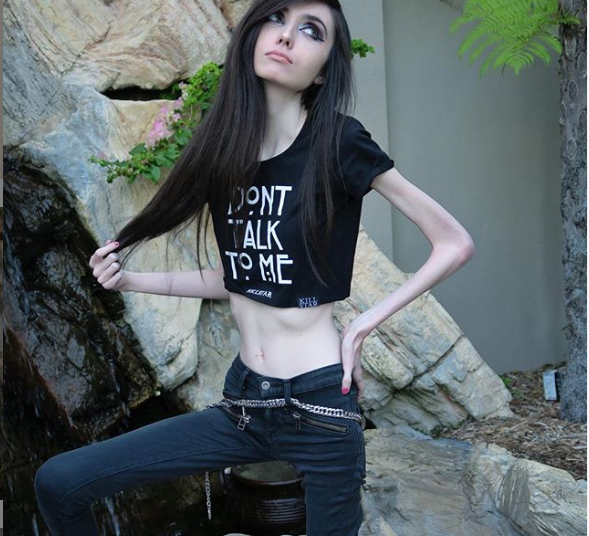 Youtuber extremadamente delgada reaparece con radical cambio