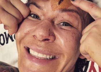 (VIDEO) Luchadora brasileña de la UFC sufre espeluznante lesión en la cabeza