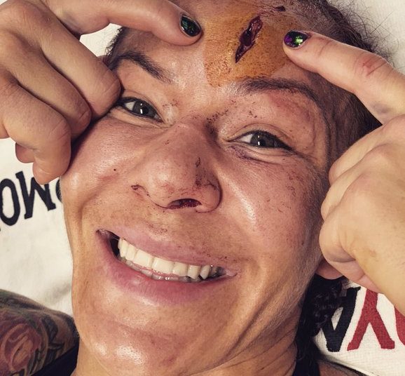 (VIDEO) Luchadora brasileña de la UFC sufre espeluznante lesión en la cabeza