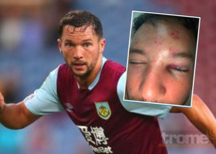 Danny Drinkwater exChelsea es golpeado por seis hombres afuera de un bar