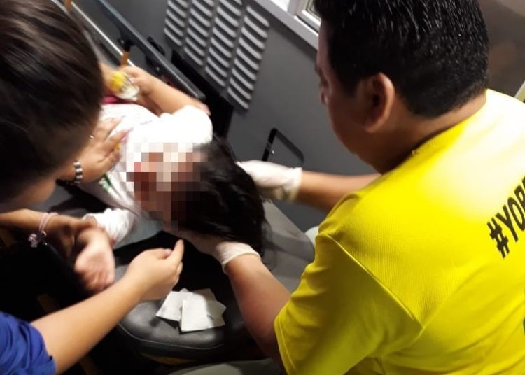 Perro pitbull muerde a una niña en Cuscatancingo