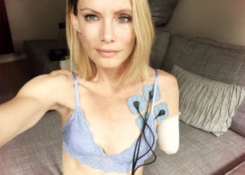 El drama de la doble de riesgo de Milla Jovovich que perdió un brazo en la filmación de Resident Evil