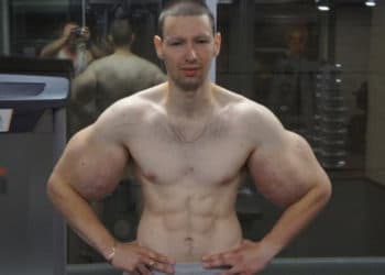 (VIDEO) El ruso que se inyectó aceite en los bíceps debutó en MMA y perdió