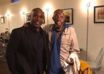 Practican primer trasplante de cara a un afroamericano