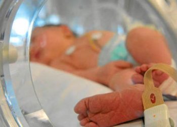 Nace un bebé sin rostro en Portugal y demandan al doctor por negligencia