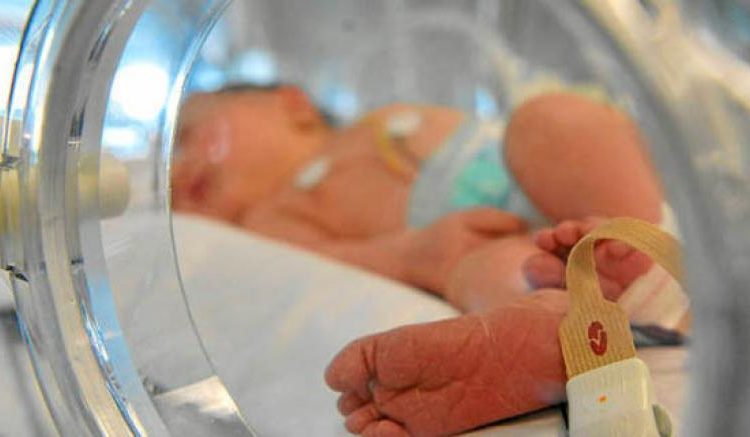 Nace un bebé sin rostro en Portugal y demandan al doctor por negligencia