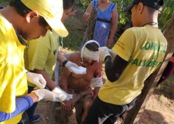 Pitbulls atacan a hombre en Zapotitán y le destrozan brazo y rostro