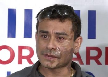 Un hombre arroja ácido de batería al rostro de un hispano en EE.UU.