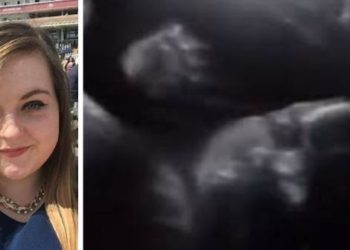 (VIDEO) Bebé saluda a sus padres desde el útero cuando aplicaban el ultrasonido