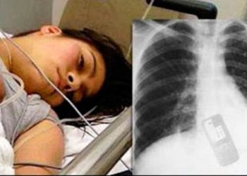 Mujer se traga celular para que su novio no pueda leer los mensajes de texto