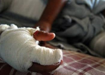 Comando de Salvamento reporta más de 60 personas quemadas con pólvora en diciembre