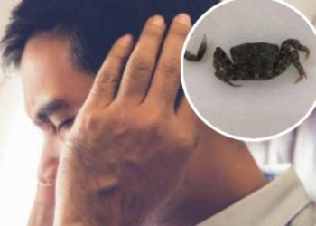 Por insoportable dolor va al médico y descubren un cangrejo en el oído