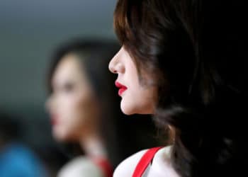 Exreina de belleza se desmaya en casa de unos amigos y acaba perdiendo parte del cráneo